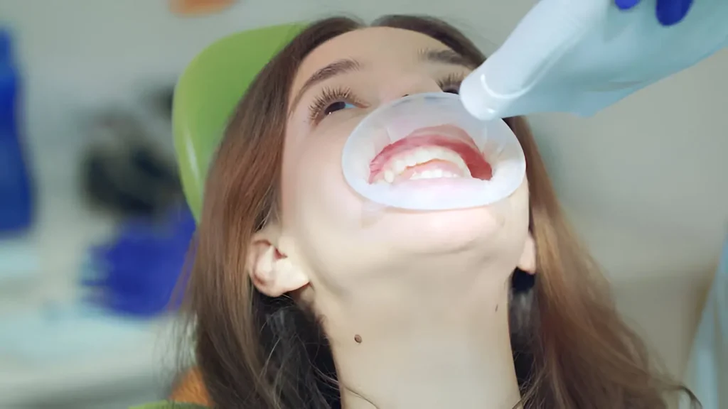 sonrisa después limpieza dental profesional