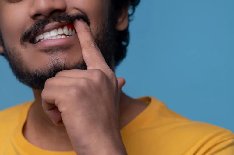 gingivitis vs periodontitis síntomas