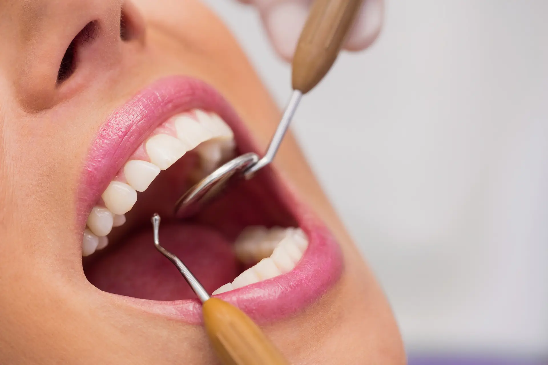 consulta limpieza dental Otavalo odontología