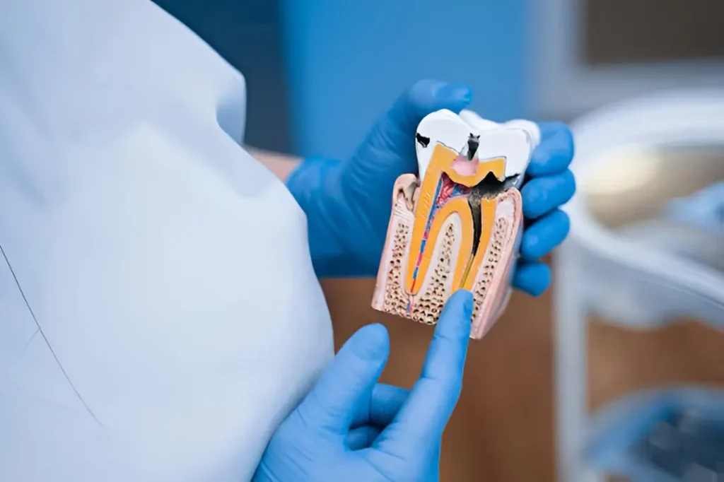 ¿Duele una endodoncia? Tratamiento en Odontología Life