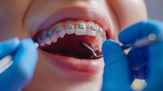 comparativa ortodoncia Otavalo