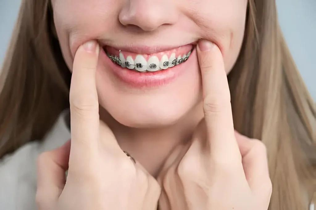 ortodoncia para adultos