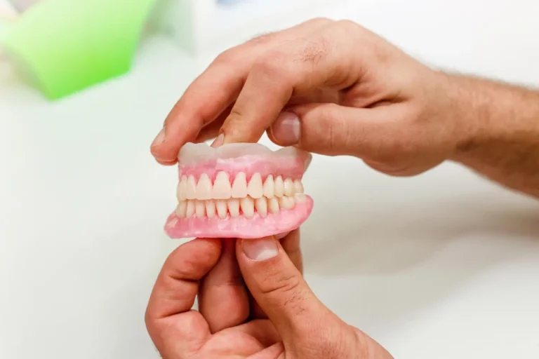 Alternativas a los implantes dentales