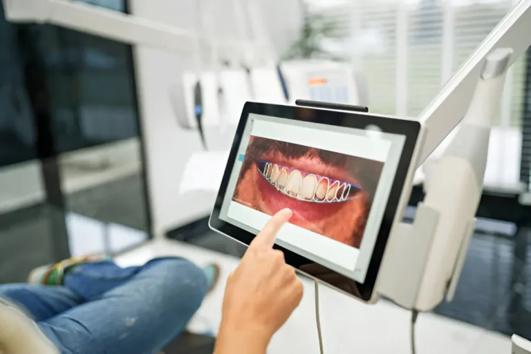 simulación diseño de sonrisa digital