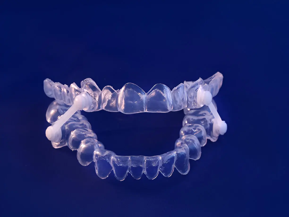 apnea del sueño y férulas dentales