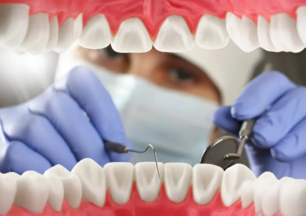 blanqueamiento dental interno procedimiento