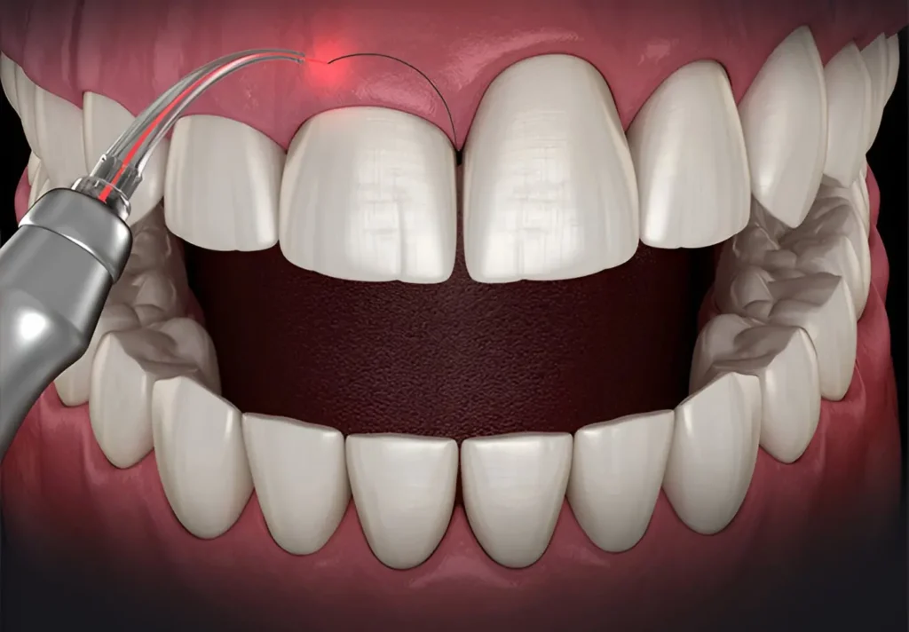 especialista en recontorneo estético de encías