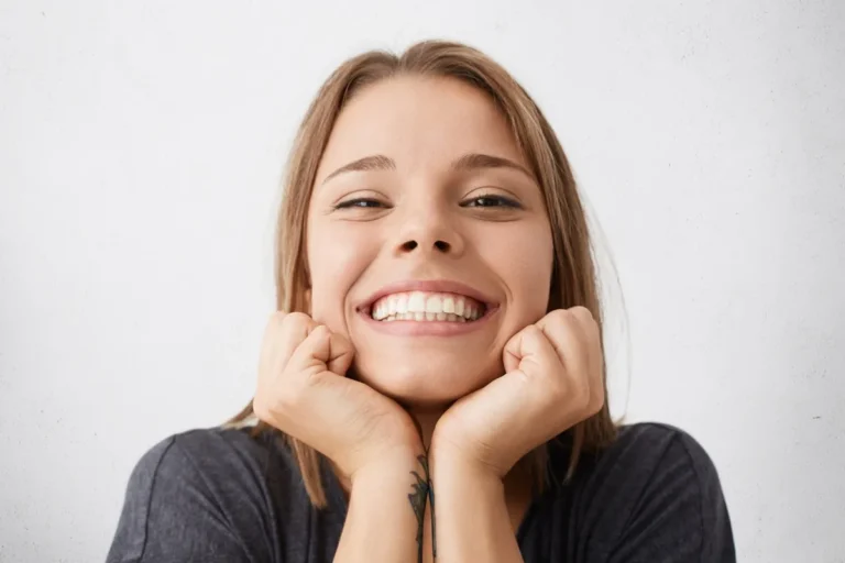 Diseño de sonrisa en Ecuador - resultado estético de carillas y blanqueamiento dental