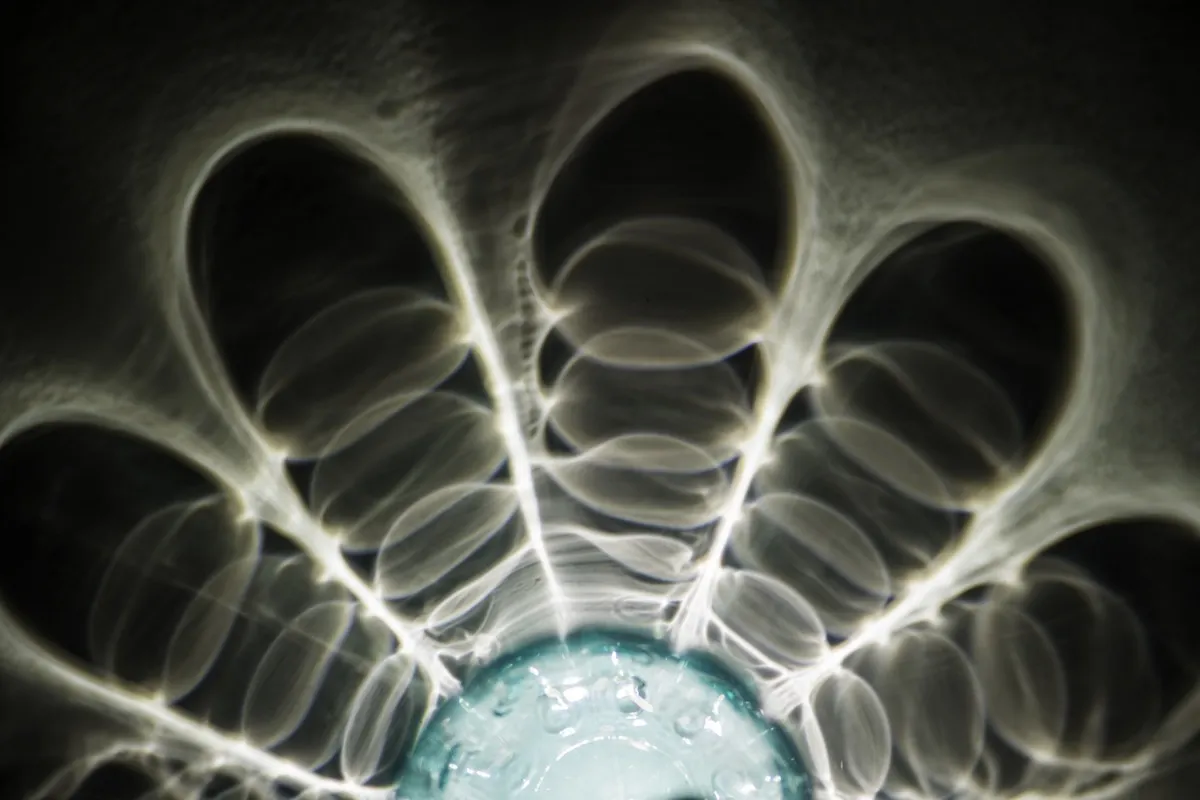 Radiografía dental conducto radicular - procedimiento endodoncia Ecuador