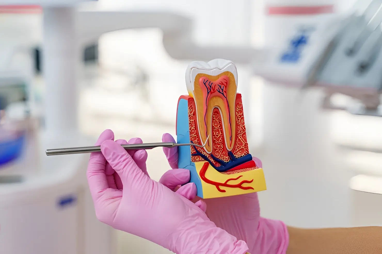 Tratamiento de endodoncia a un paciente en Ecuador