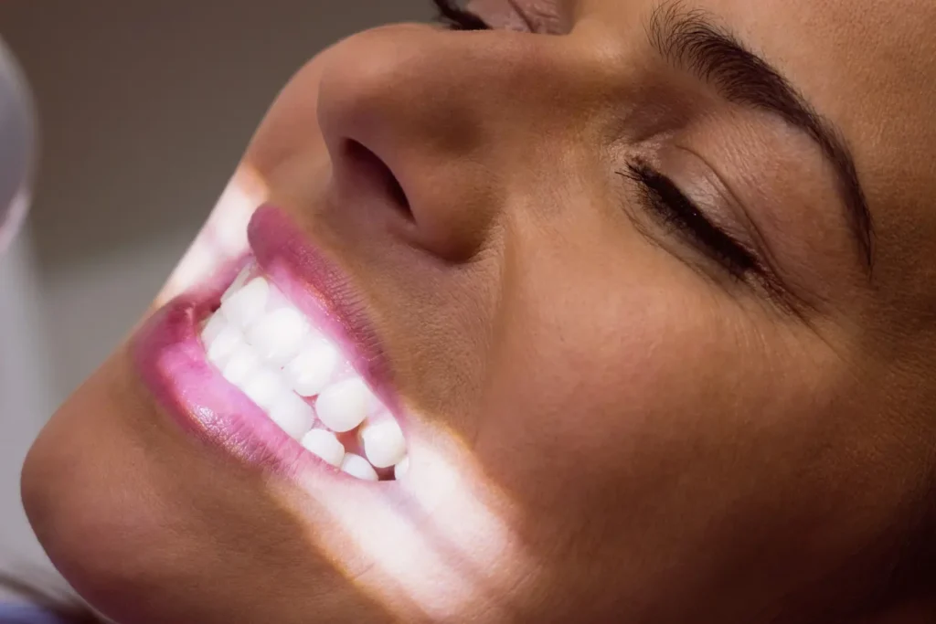 Blanqueamiento dental profesional realizado en clínica odontológica