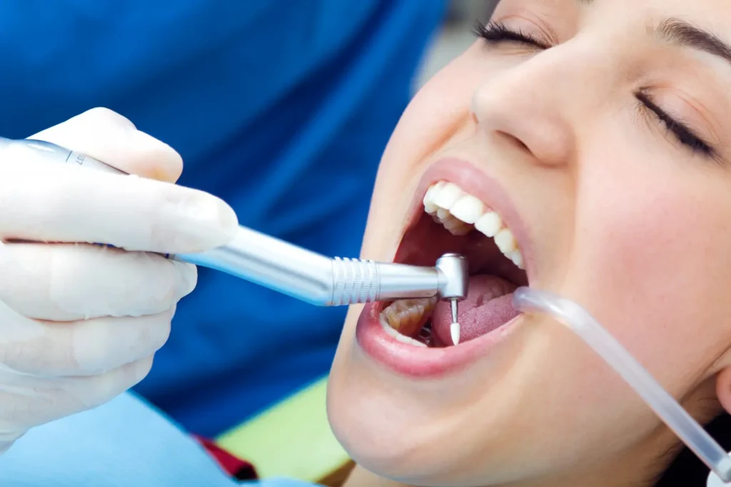 Tratamiento con calza dental para reparar un diente afectado