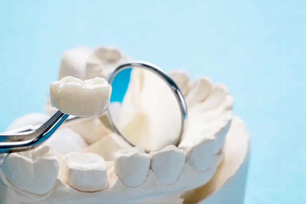 Diente con corona dental para restauración y protección