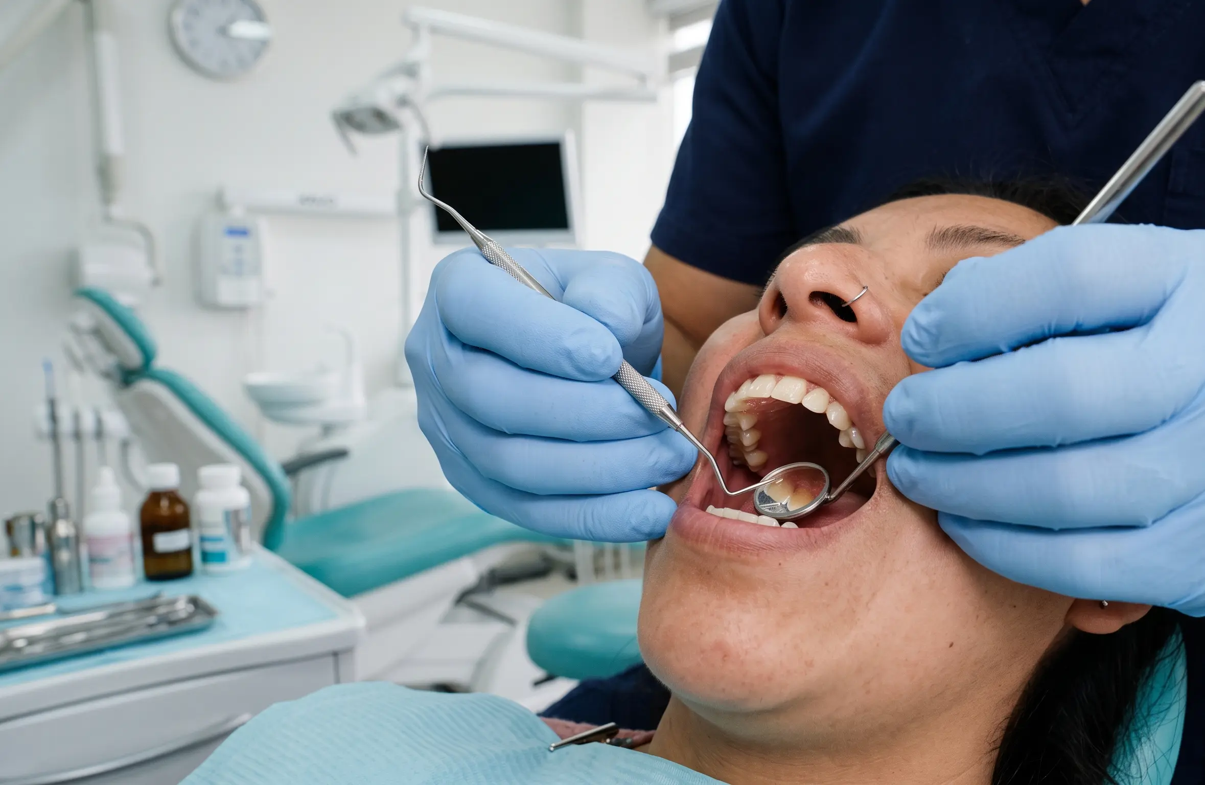 Atención dental en Peguche para cuidar la salud bucal
