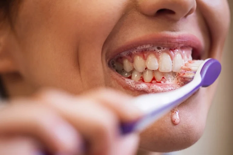 Señales tempranas de problemas dentales que requieren atención odontológica
